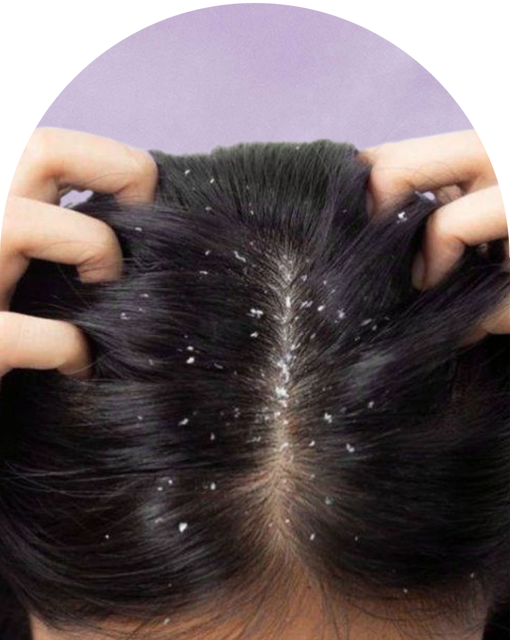 Haarproblemen